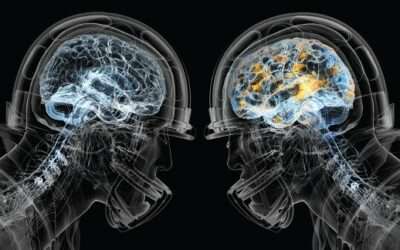 Let’s just call it what it is….Brain Damage